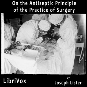 On the Antiseptic Principle of the Practice of Surgery - Joseph LISTER Listen Free Audiobook MP3 📙 Free Audiobook Websites